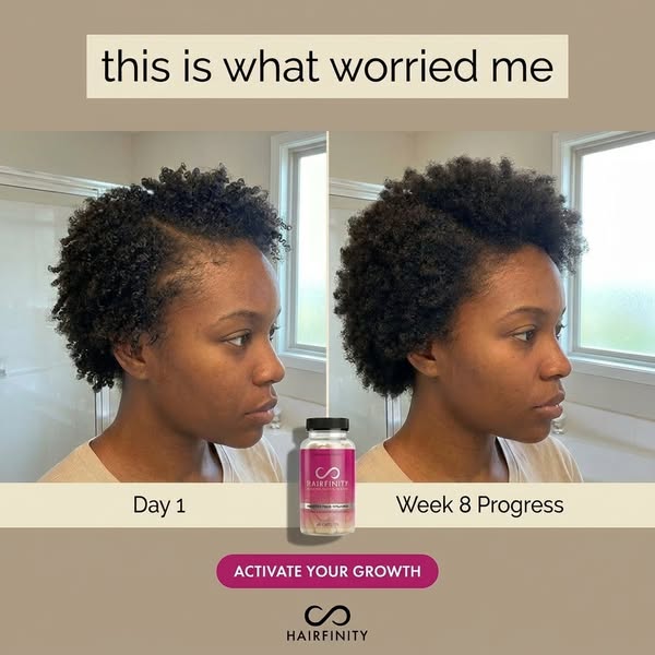 This image ad shows a before and after photo of a woman's hair after 8 weeks of using Hairfinity hair growth supplem