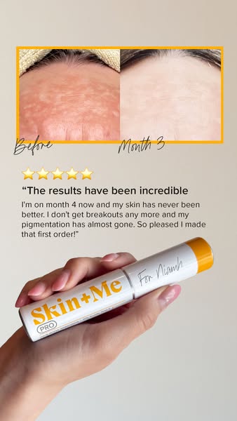 Skin + Me ad