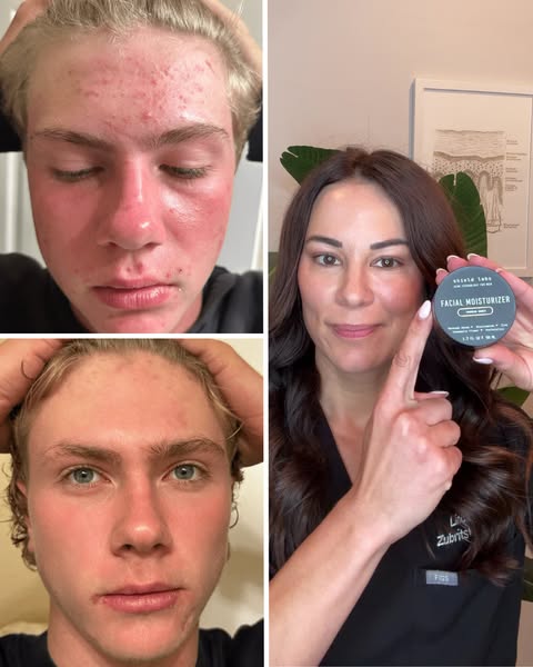Dermguru ad