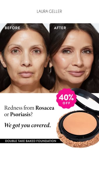 This ad for Laura Geller Double Take Baked Foundation features a before and after image of a woman with redness from ros