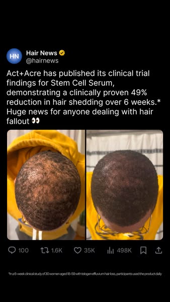 ActandAcre ad
