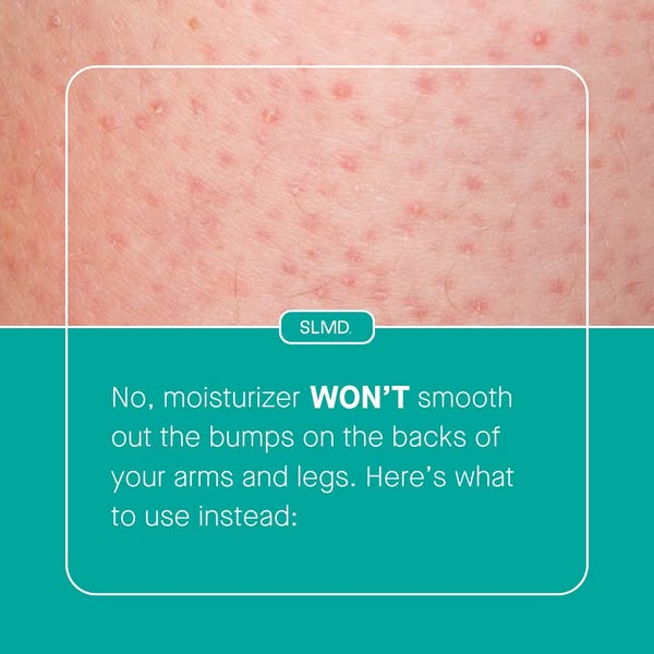 Dr Sandra Lee aka drpimplepopper ad