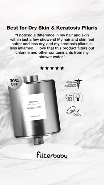 This ad promotes Filterbaby shower filters as a solution for dry skin and keratosis pilaris. It uses a customer testimon