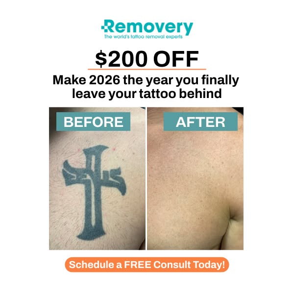 This ad for Removery uses a before and after image to show the effectiveness of their tattoo removal services. It includ