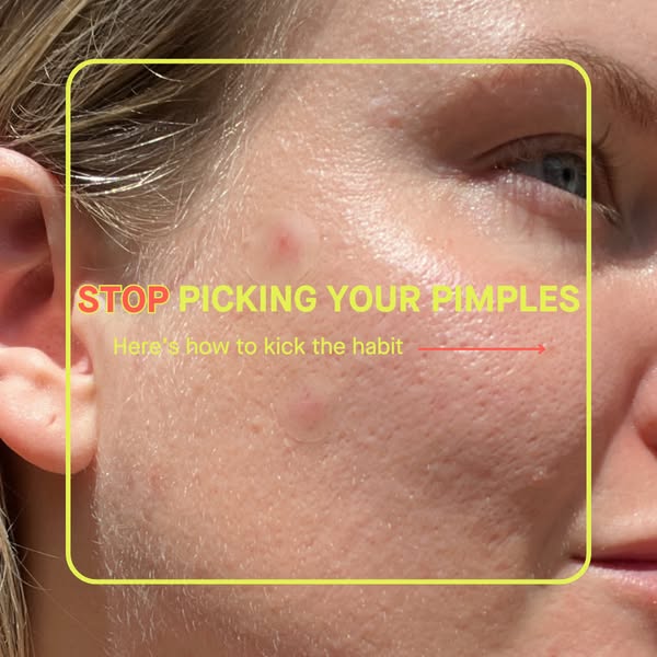Dr Sandra Lee aka drpimplepopper ad