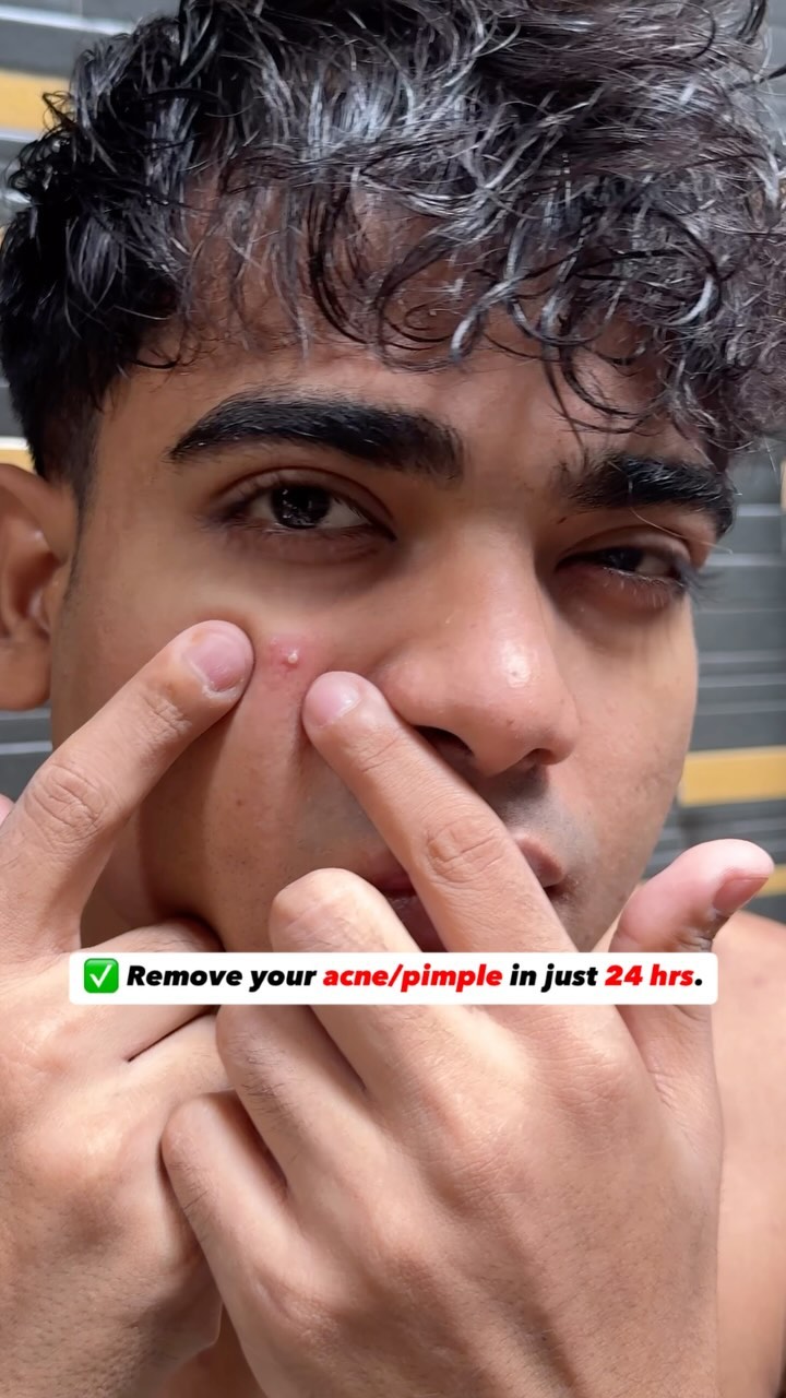 Virat  ad