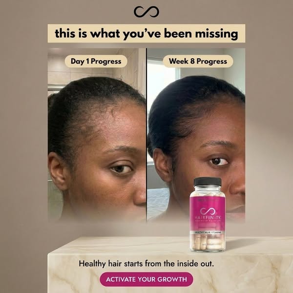 This image ad for Hairfinity shows a before-and-after of a woman's hair with the headline, "this is what you