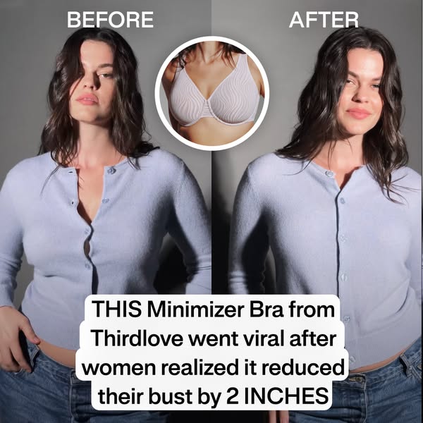 This ad shows a before and after of a woman wearing a minimizer bra from Thirdlove. The ad claims that the bra reduces b