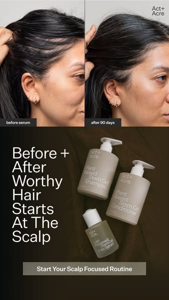 This ad for Act+Acre showcases a before and after photo of a woman's hairline, paired with the Act+Acre product line