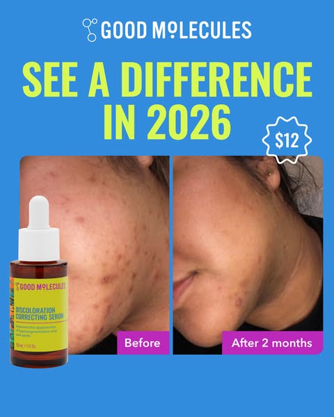 This ad for Good Molecules Discoloration Correcting Serum shows before and after photos of a woman's face with a cla