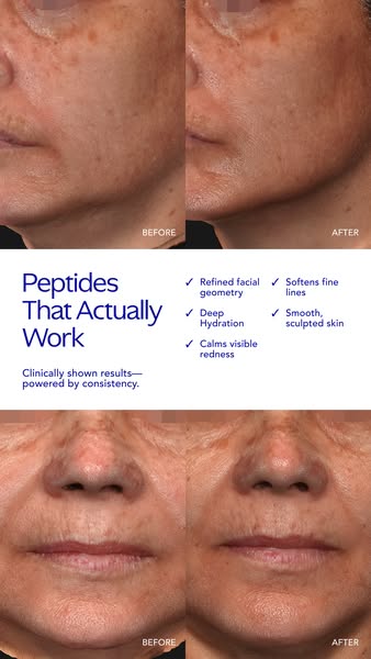 This ad uses before and after photos to demonstrate the effectiveness of a peptide product. The ad highlights the produc