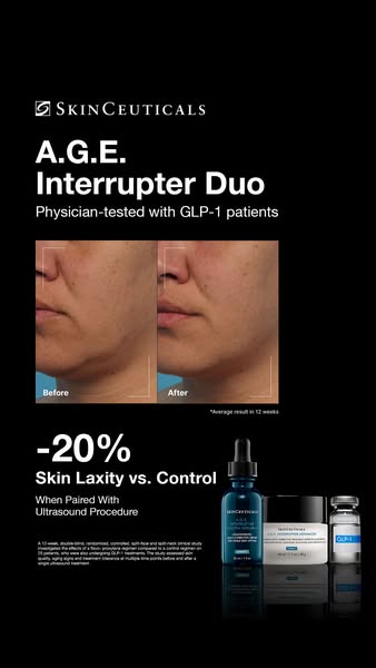 This image ad for SkinCeuticals A.G.E. Interrupter Duo features before and after photos of a woman's face, highlight