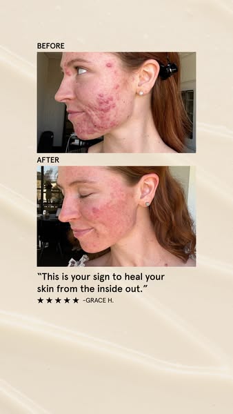 Grace Lauren Harvey ad
