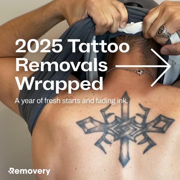 This ad promotes Removery by highlighting tattoo removals from the past year.