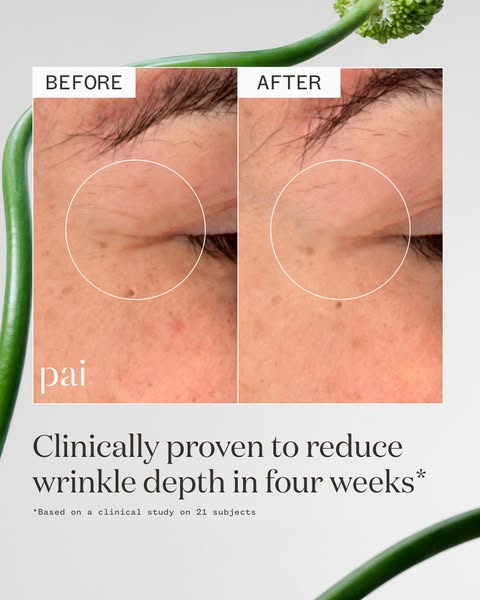 This ad is for Pai skincare. It shows before and after images of skin around the eye and promises to reduce wrinkle dept