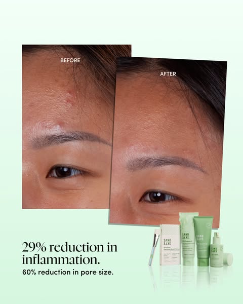 This ad compares before and after photos of a woman's forehead using Sand & Sky products. The ad highlights the 