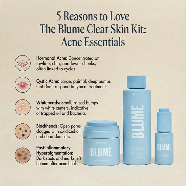 This ad for Blume's Clear Skin Kit highlights 5 reasons to love the product, focusing on its effectiveness against v