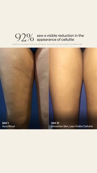 This ad features a split-screen before and after image to demonstrate the results of a product on cellulite reduction, s
