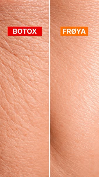 This ad uses a before and after comparison to suggest that the brand Frøya can create the same wrinkle-reducing effects 