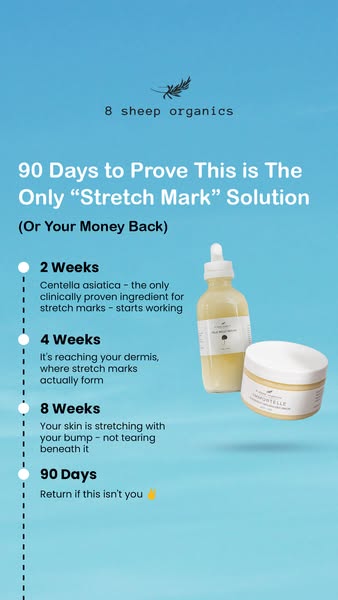 An ad for 8 Sheep Organics promoting a stretch mark solution. The ad shows the brand's product in a timeline format 