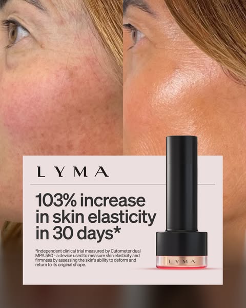 This ad features a before and after image of a woman's face, highlighting the improvement in skin elasticity after 3
