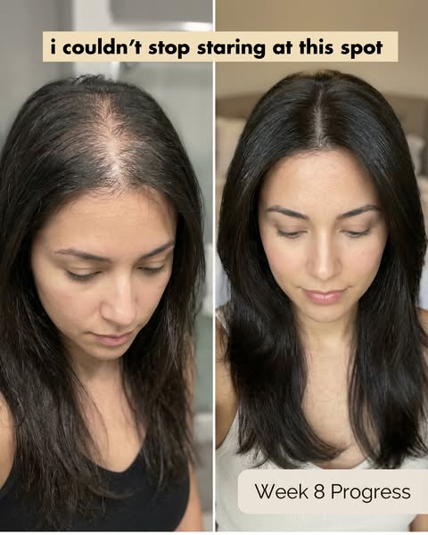 This ad shows a split-screen before-and-after image, with a woman displaying thinning hair on the left and fuller hair o