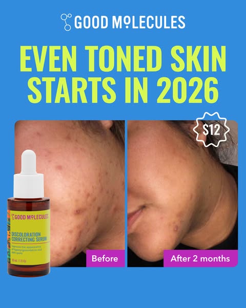 This image ad for Good Molecules Discoloration Correcting Serum uses a before and after format to show the product's