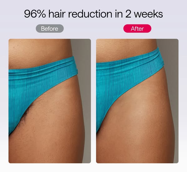 This image ad shows before and after images of a woman's bikini line after using a hair removal product for two week