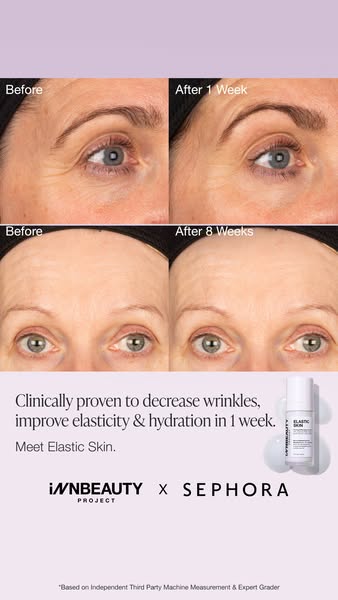 An image ad promoting INNBEAUTY PROJECT's Elastic Skin product line, available at Sephora. The ad showcases before a