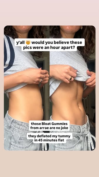 An image ad featuring before and after pictures of the creator's stomach with the claim that Arrae Bloat Gummies def