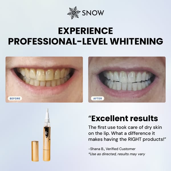 This ad for Snow teeth whitening features a before and after photo of a customer's teeth, along with a testimonial a