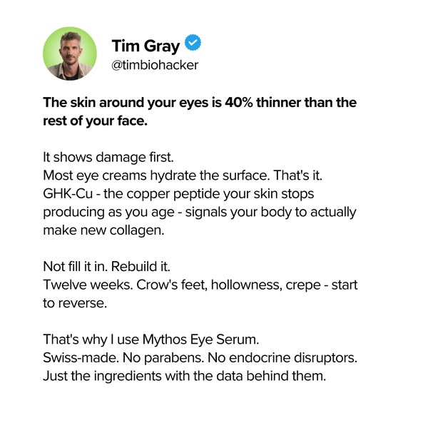 Tim Gray ad
