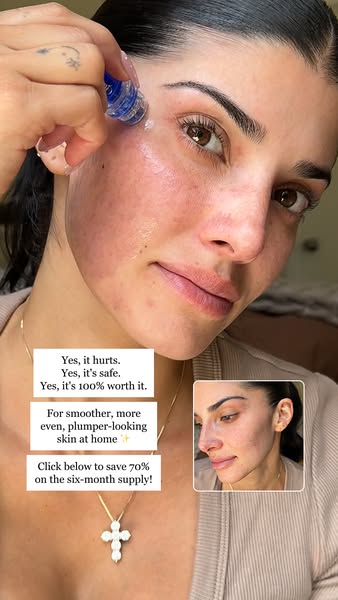 analysetalavera ad