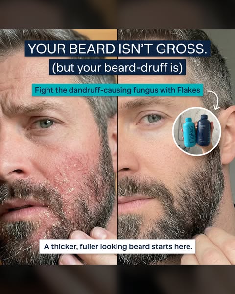 This ad utilizes a before/after format to showcase the effectiveness of Flakes in treating beard dandruff and promoting 