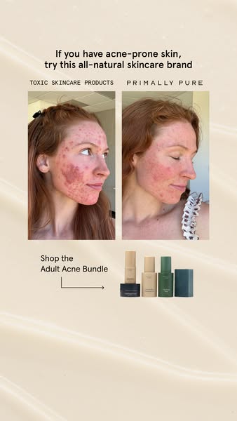 This image ad compares "toxic skincare products" with Primally Pure, showcasing a before and after photo of so