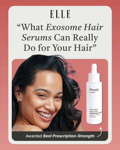 This ad highlights a hair serum from Musely FaceRx, endorsed by Elle magazine, targeting individuals experiencing hair l