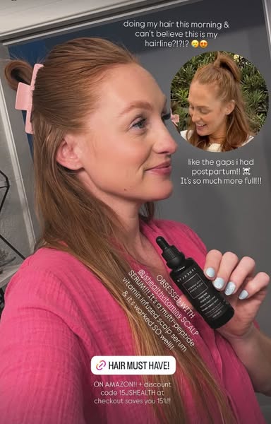 The ad features a woman with red hair sharing her positive experience with JSHealth Vitamins Scalp Serum. She highlights
