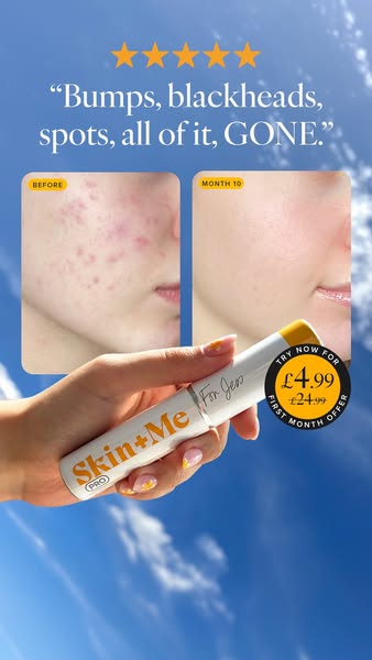 Skin + Me ad