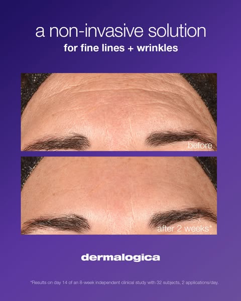 Dermalogica Canada ad