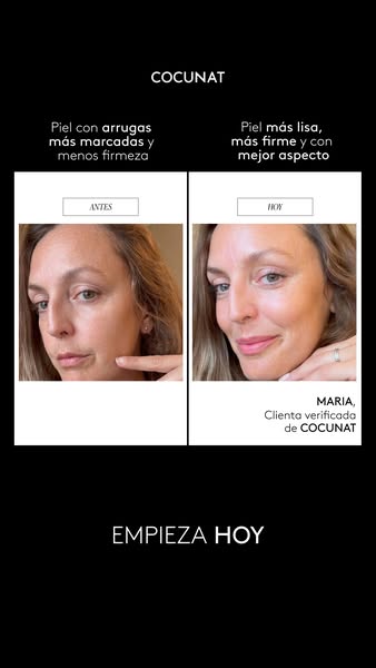 This ad uses a before and after format to show the potential results of using Cocunat products. It features a woman'