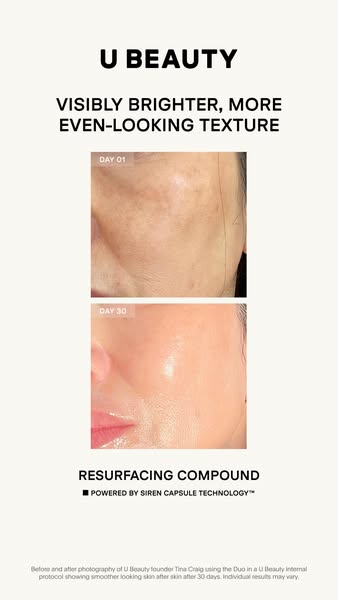 U Beauty Skincare ad
