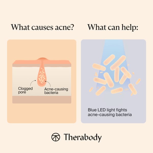 This ad is designed to inform the user of the cause of acne and how blue LED light can help resolve the problem.