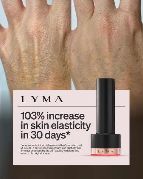 This ad showcases the LYMA product and its ability to increase skin elasticity in 30 days.