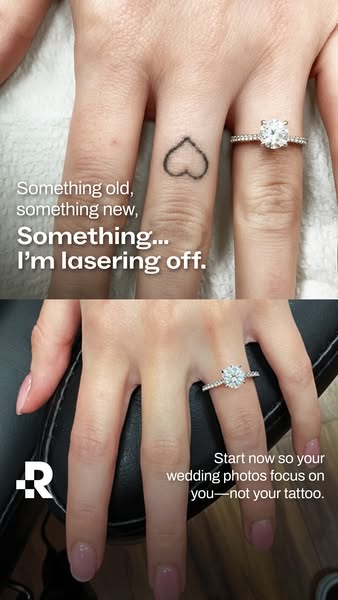 This ad highlights the problem of having a tattoo that the subject doesn't want to be visible in their wedding photo