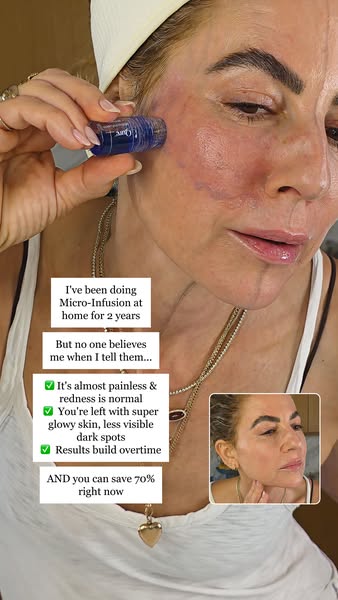 Dewy Faced B ad