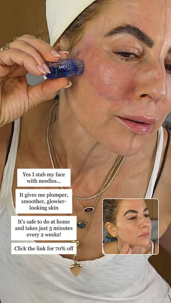 Dewy Faced B ad