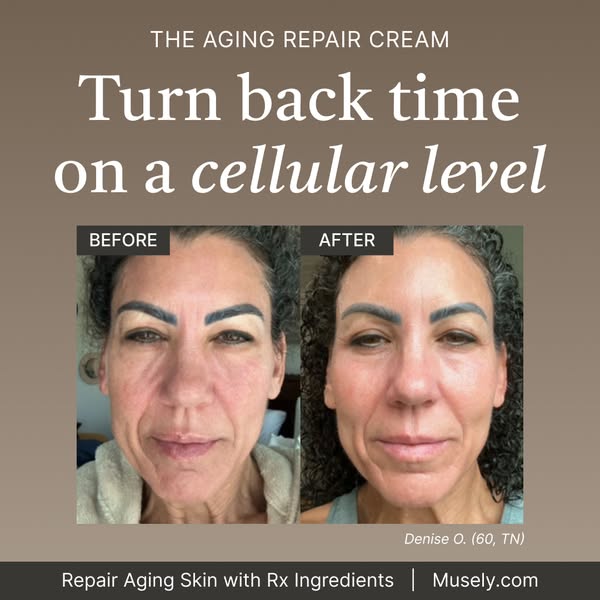 This ad features before and after photos of a woman to demonstrate the effects of The Aging Repair Cream from Musely.