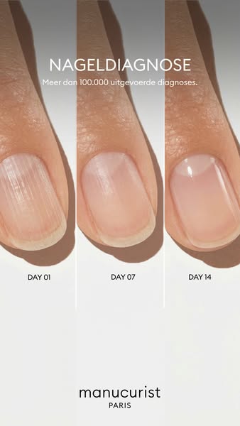 This image ad by Manucurist Paris displays the transformation of a nail over 14 days. The ad promotes the brand's na