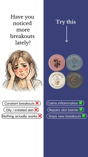 The ad image highlights the frustration of constant breakouts and promotes Norse Organics as a solution. It contrasts th