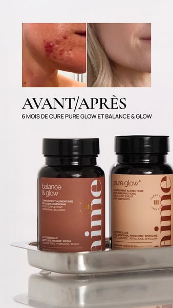 This image ad uses a before and after format to promote Aime skin supplements. It features a before and after image of a